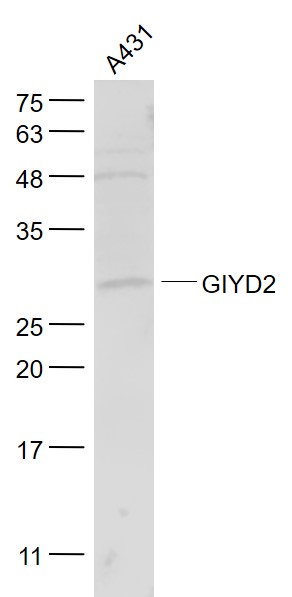 1 - GIYD2 Rabbit pAb AP55145