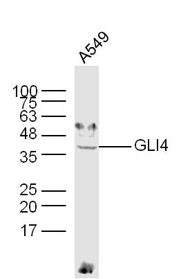 1 - GLI4 Rabbit pAb AP55149