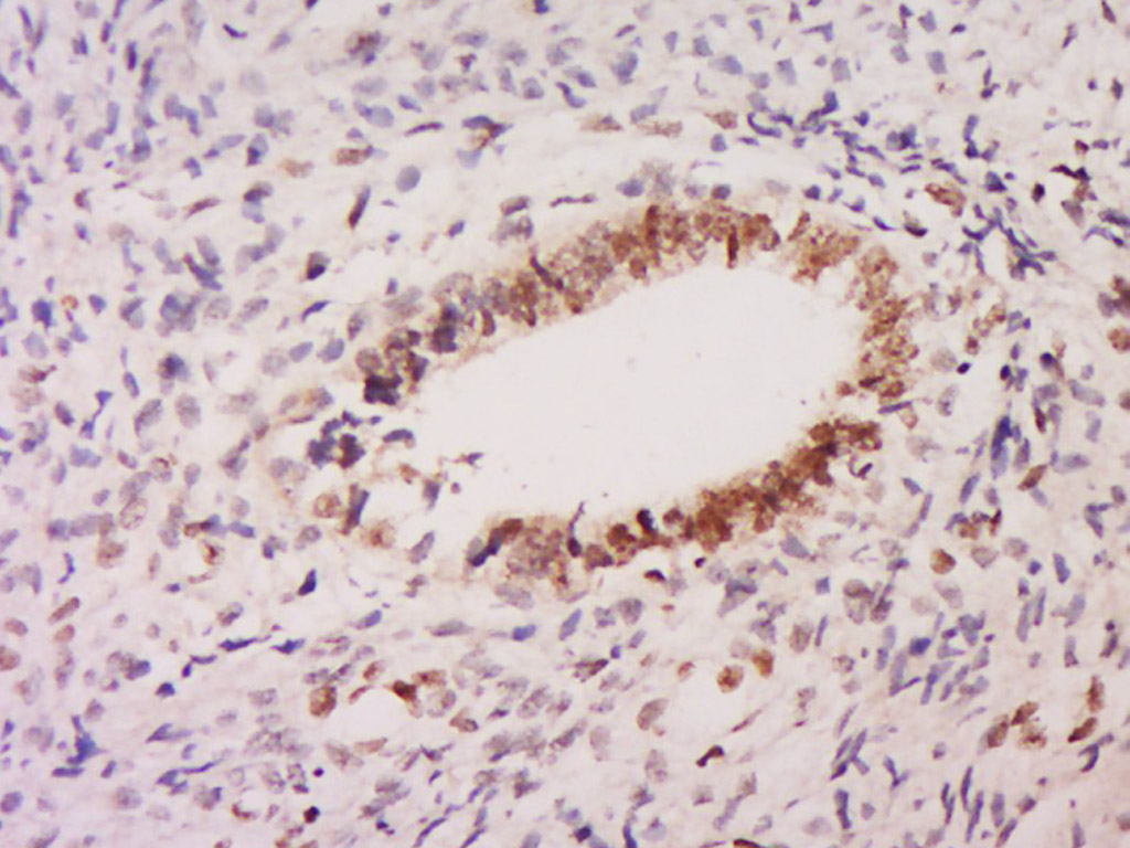 14 - GLI4 Rabbit pAb AP55149
