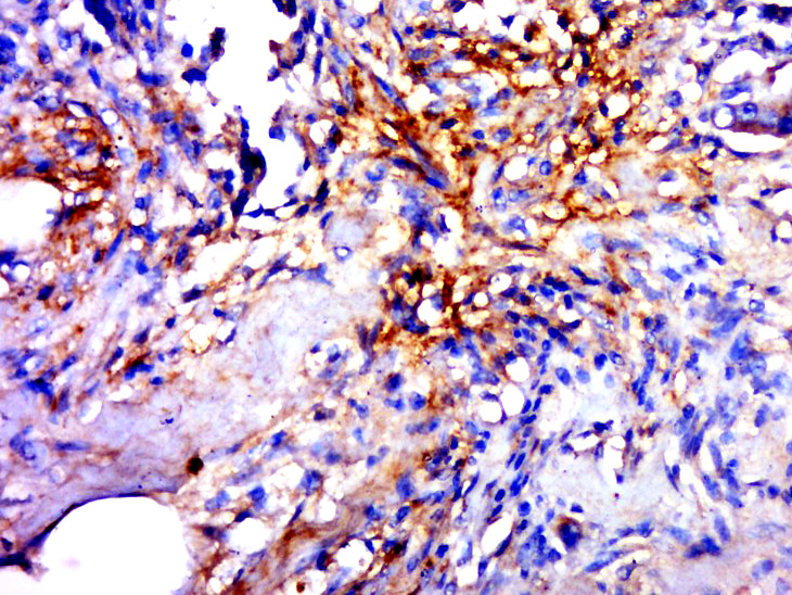 14 - GLT1D1 Rabbit pAb AP55151