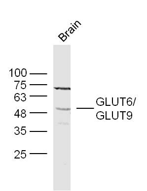1 - GLUT6 Rabbit pAb AP55157