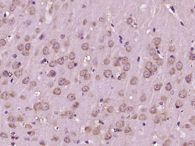 14 - Glutathione Transferase zeta 1 Rabbit pAb AP55159