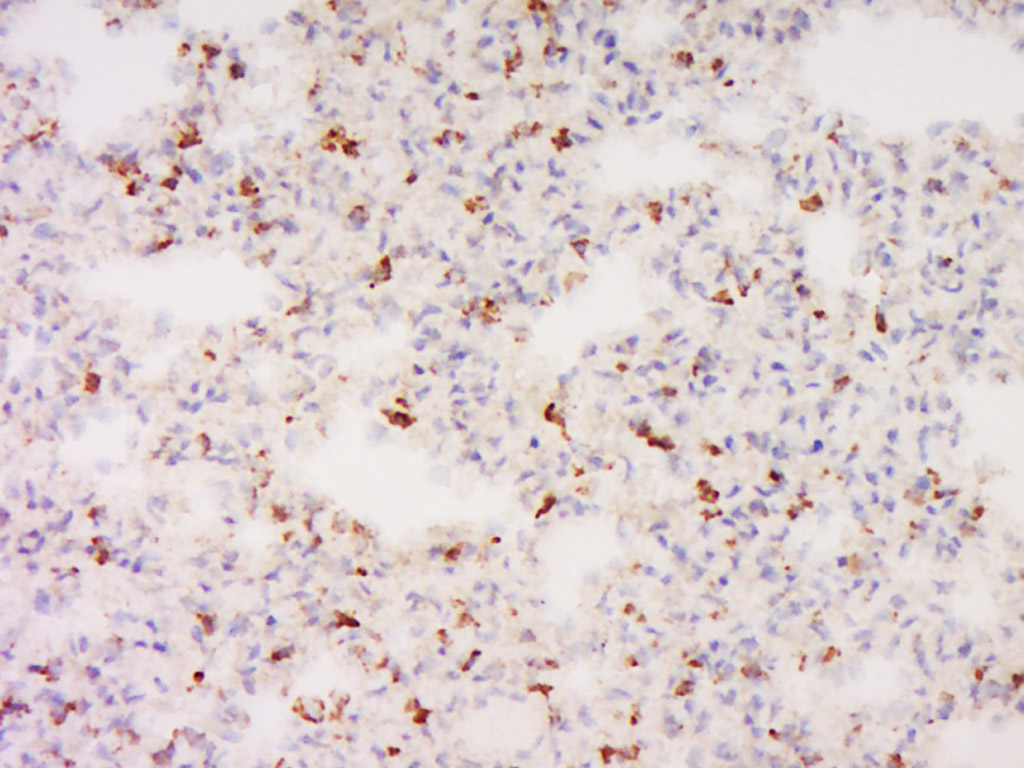 14 - GNG11 Rabbit pAb AP55170