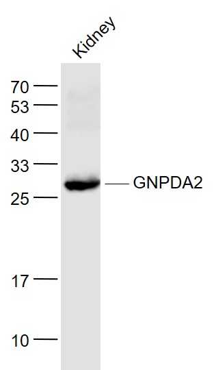 1 - GNPDA2 Rabbit pAb AP55172