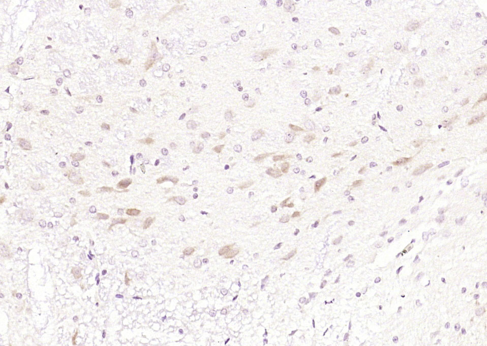 14 - GNPDA2 Rabbit pAb AP55172
