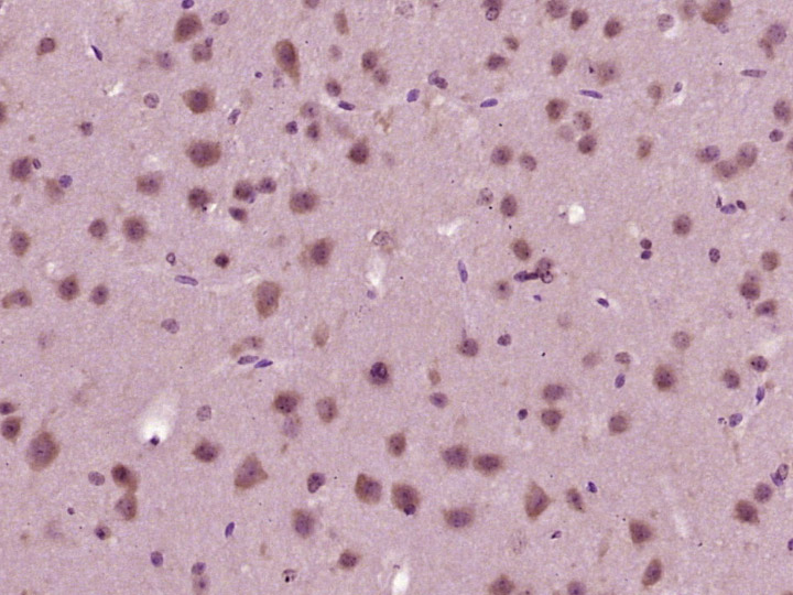 14 - Golgin subfamily A member 4 Rabbit pAb AP55178
