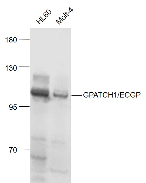 1 - GPATCH1/ECGP Rabbit pAb AP55183