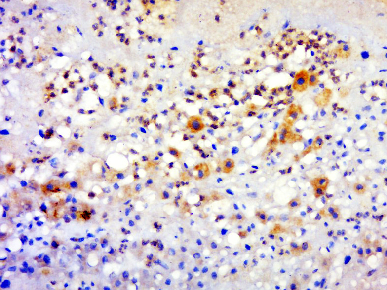 14 - GPATCH3 Rabbit pAb AP55185