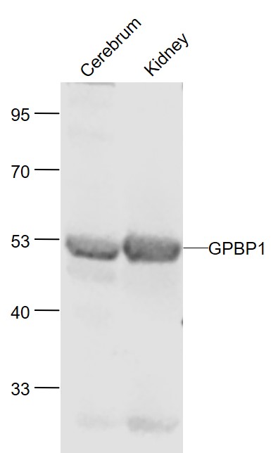 1 - GPBP1 Rabbit pAb AP55187