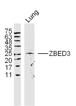 1 - ZBED3 Rabbit pAb AP55196