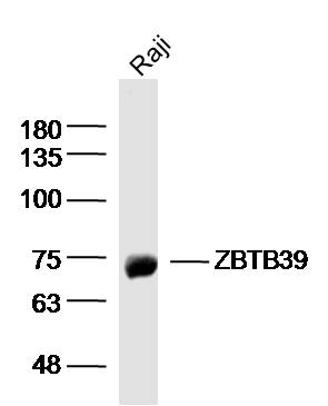 1 - ZBTB39 Rabbit pAb AP55207