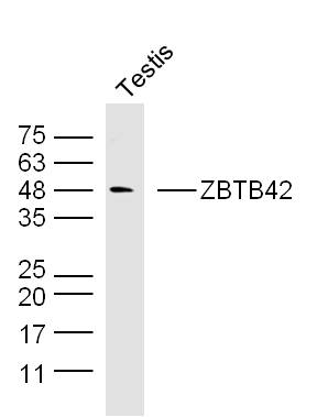 1 - ZBTB42 Rabbit pAb AP55209