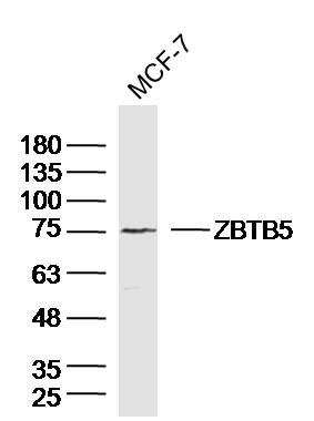 1 - ZBTB5 Rabbit pAb AP55211