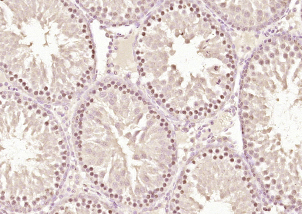 14 - ZNF575 Rabbit pAb AP55212