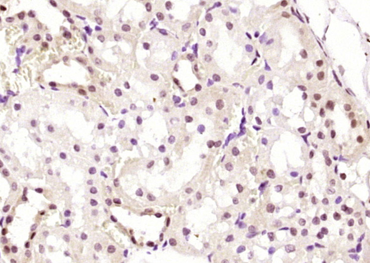 14 - HESX1 Rabbit pAb AP55213