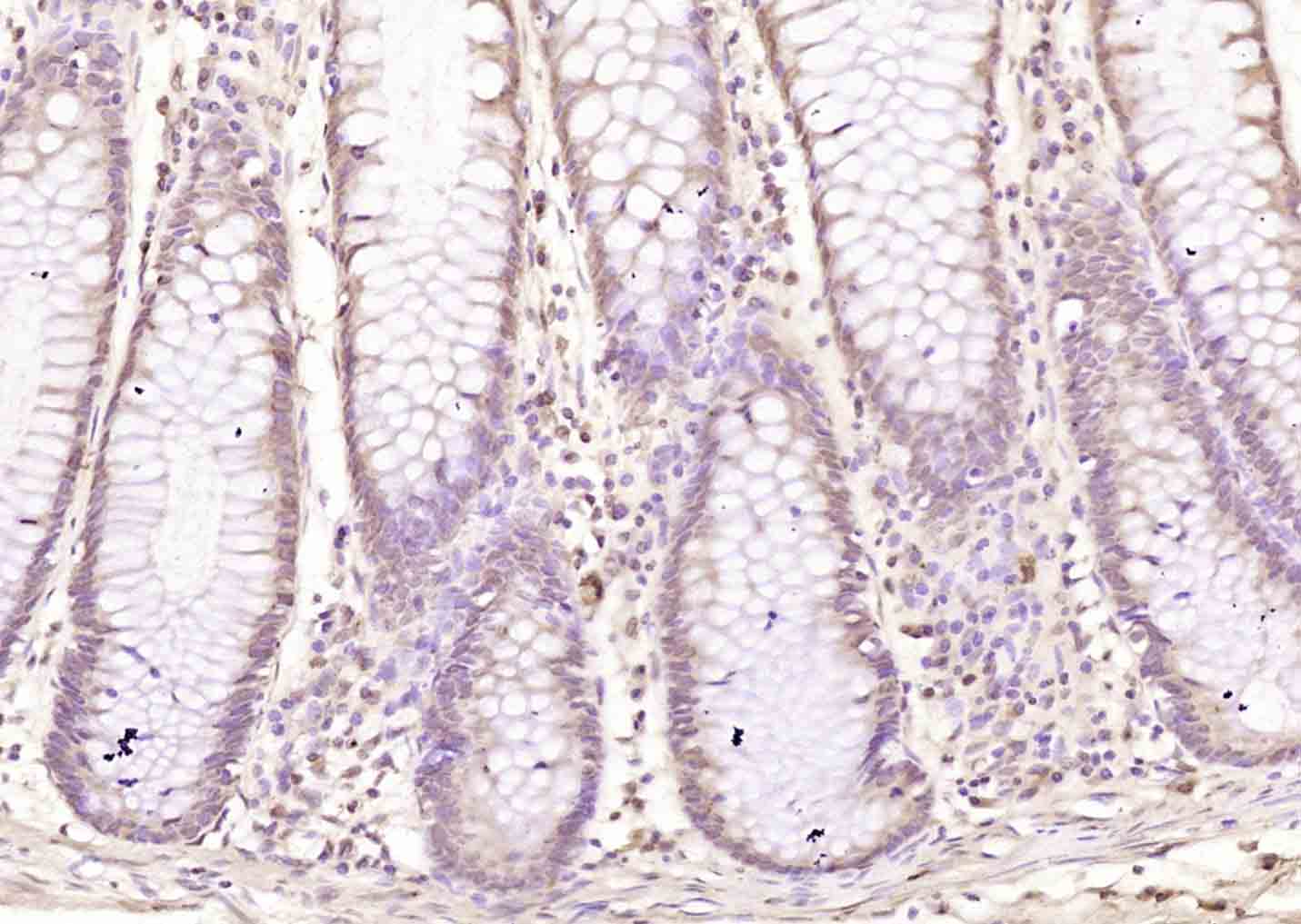 0 - ZMYM2 Rabbit pAb AP55217