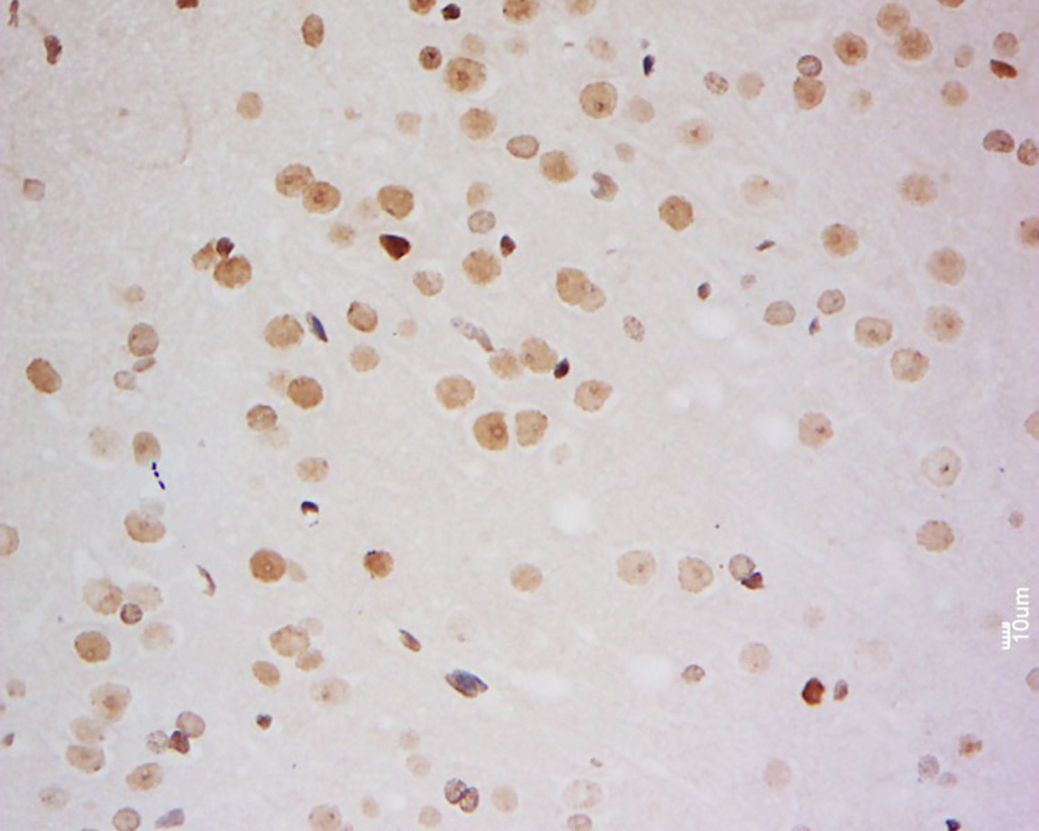 14 - ZMYM2 Rabbit pAb AP55217