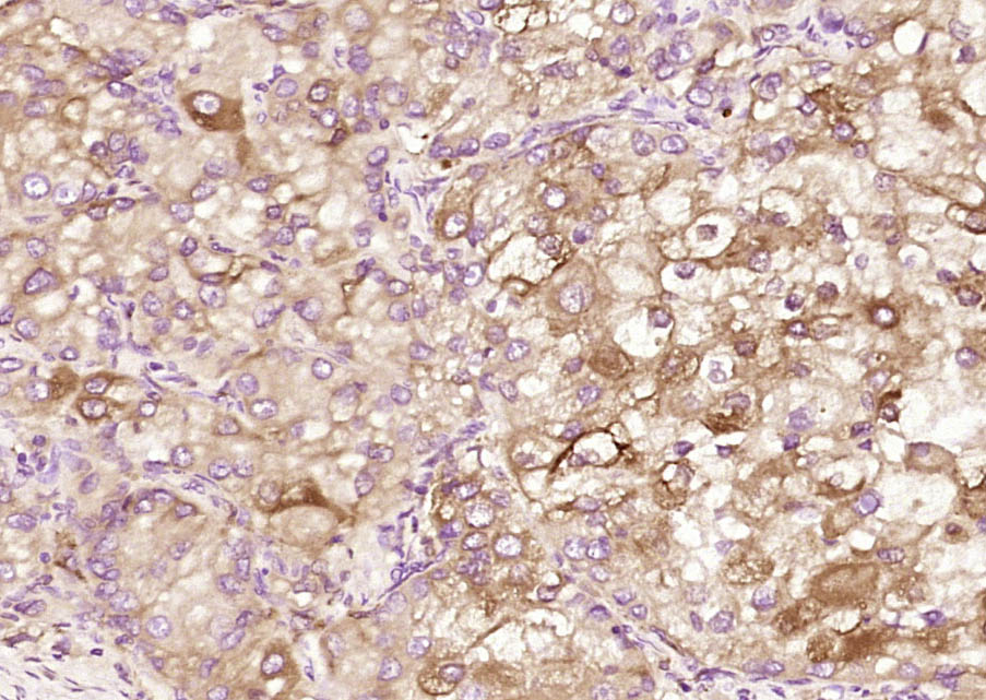 14 - CED6 Rabbit pAb AP55224