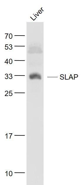 1 - SLAP Rabbit pAb AP55236