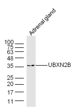 1 - UBXN2B Rabbit pAb AP55239