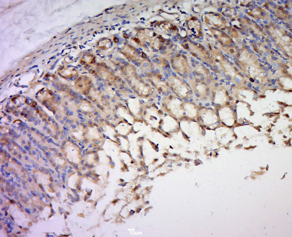 14 - UBXN2B Rabbit pAb AP55239