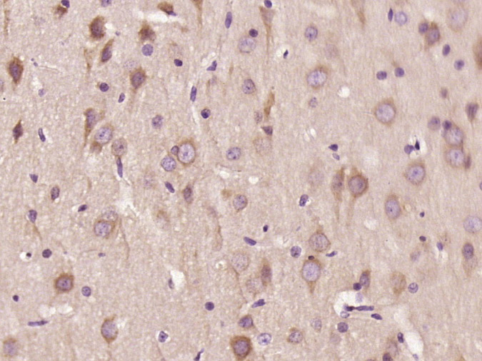 14 - WDR91 Rabbit pAb AP55241