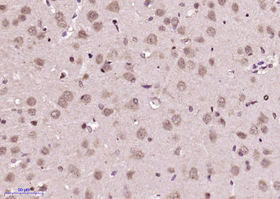 14 - Netrin 5 Rabbit pAb AP55253