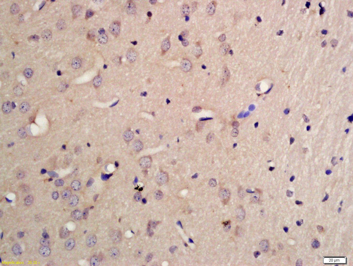 14 - PCDHB10 Rabbit pAb AP55256