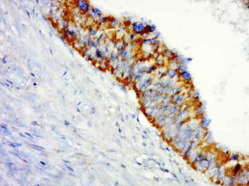 14 - SHROOM1 Rabbit pAb AP55263