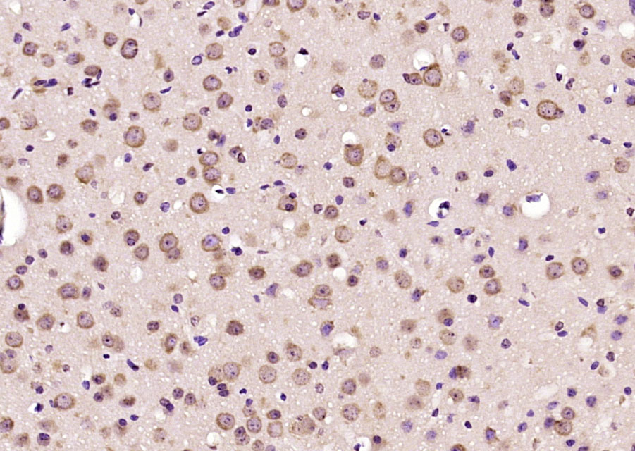 14 - MRP63 Rabbit pAb AP55276