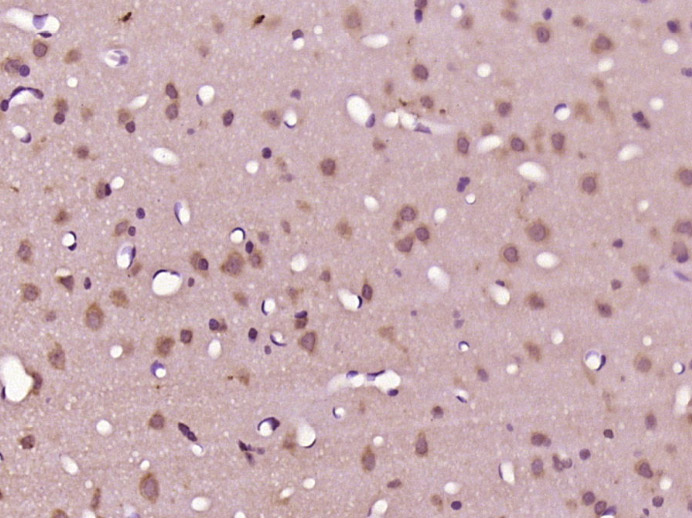 14 - NUDCD3 Rabbit pAb AP55278