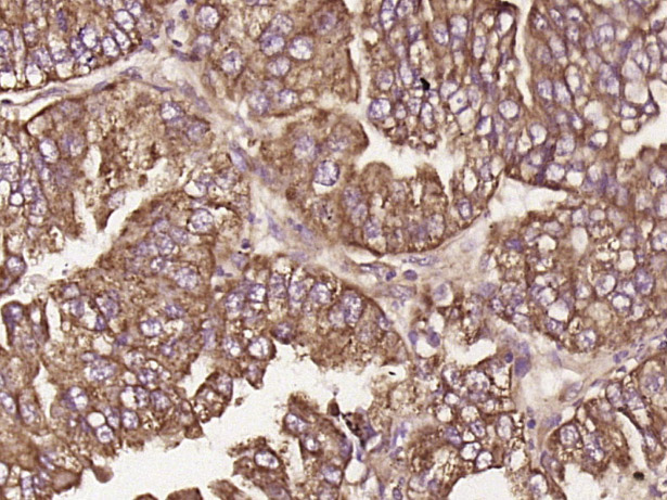 14 - C19orf57 Rabbit pAb AP55288