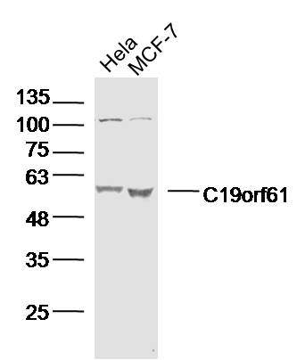 1 - C19orf61 Rabbit pAb AP55289