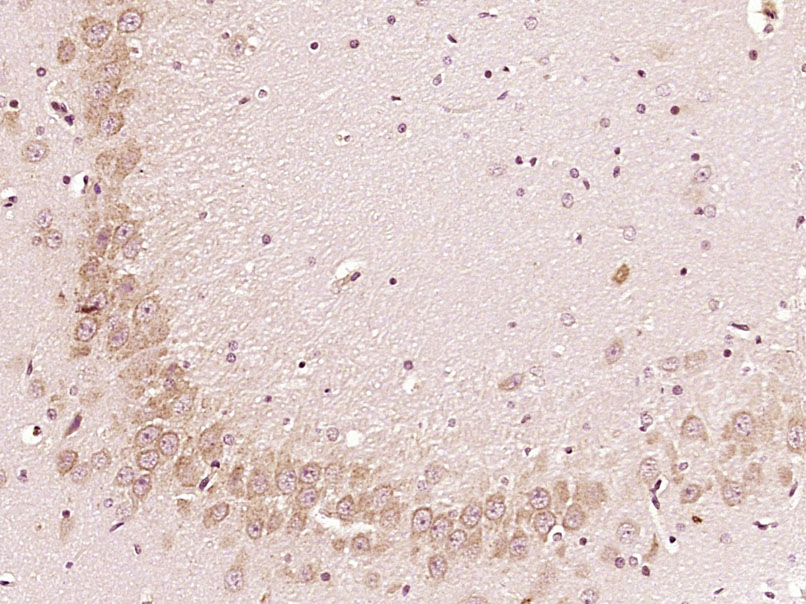 14 - C19orf61 Rabbit pAb AP55289