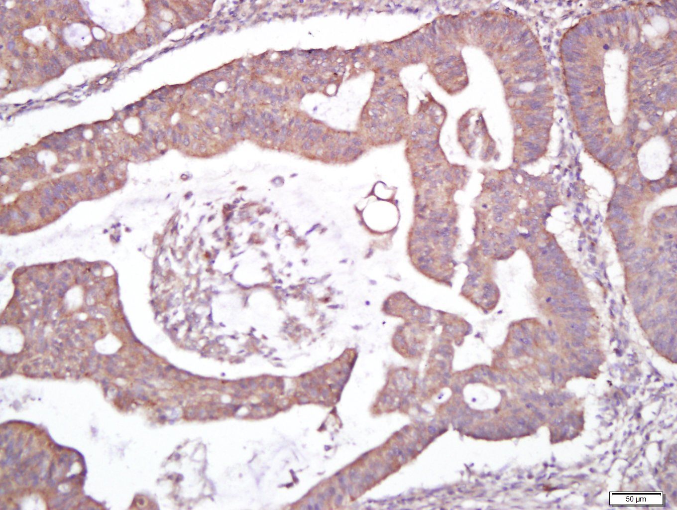 14 - CELSR1 Rabbit pAb AP55309