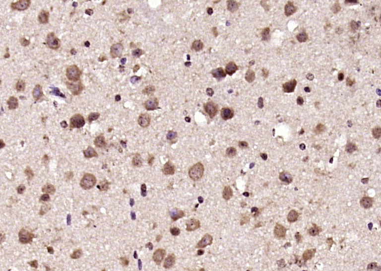 14 - CENPJ Rabbit pAb AP55312