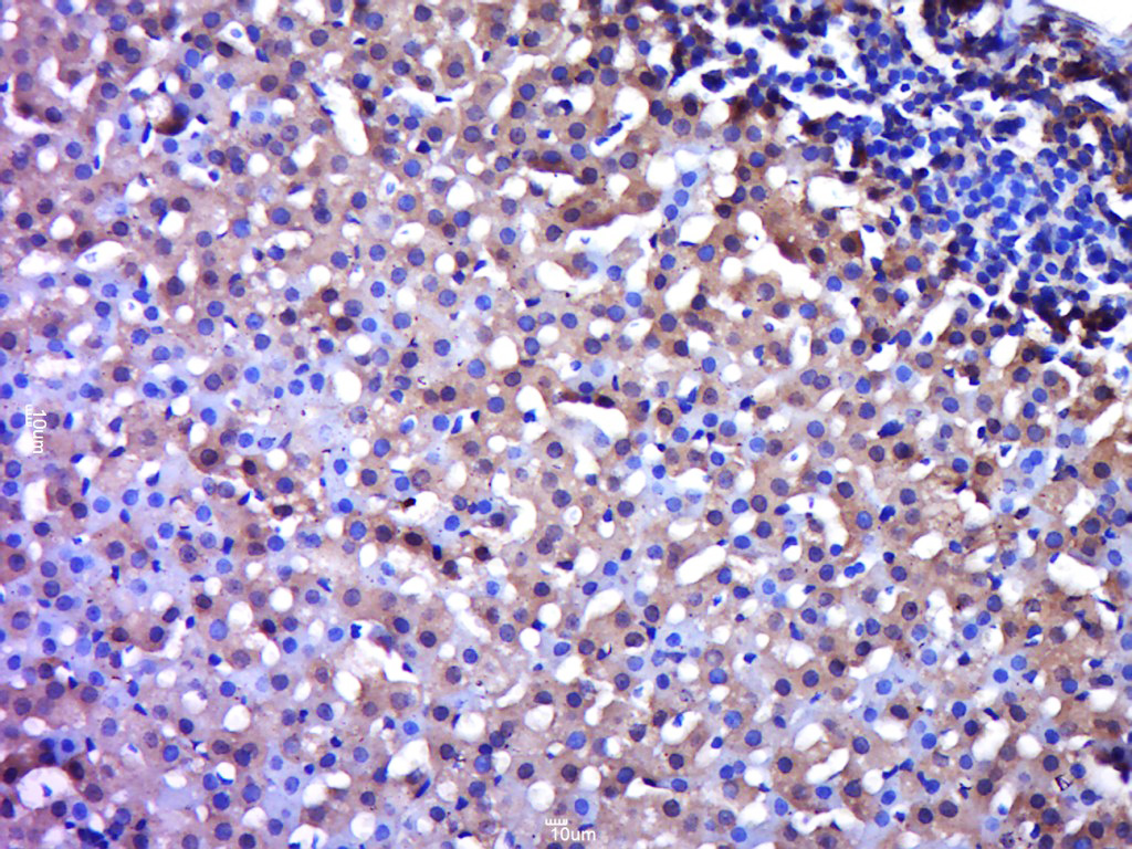 14 - Centaurin alpha 2 Rabbit pAb AP55315