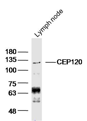 1 - CEP120 Rabbit pAb AP55319