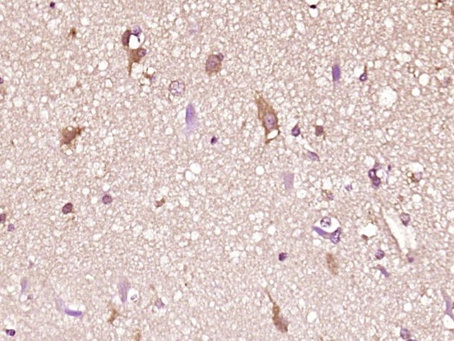 14 - CFC1 Rabbit pAb AP55325
