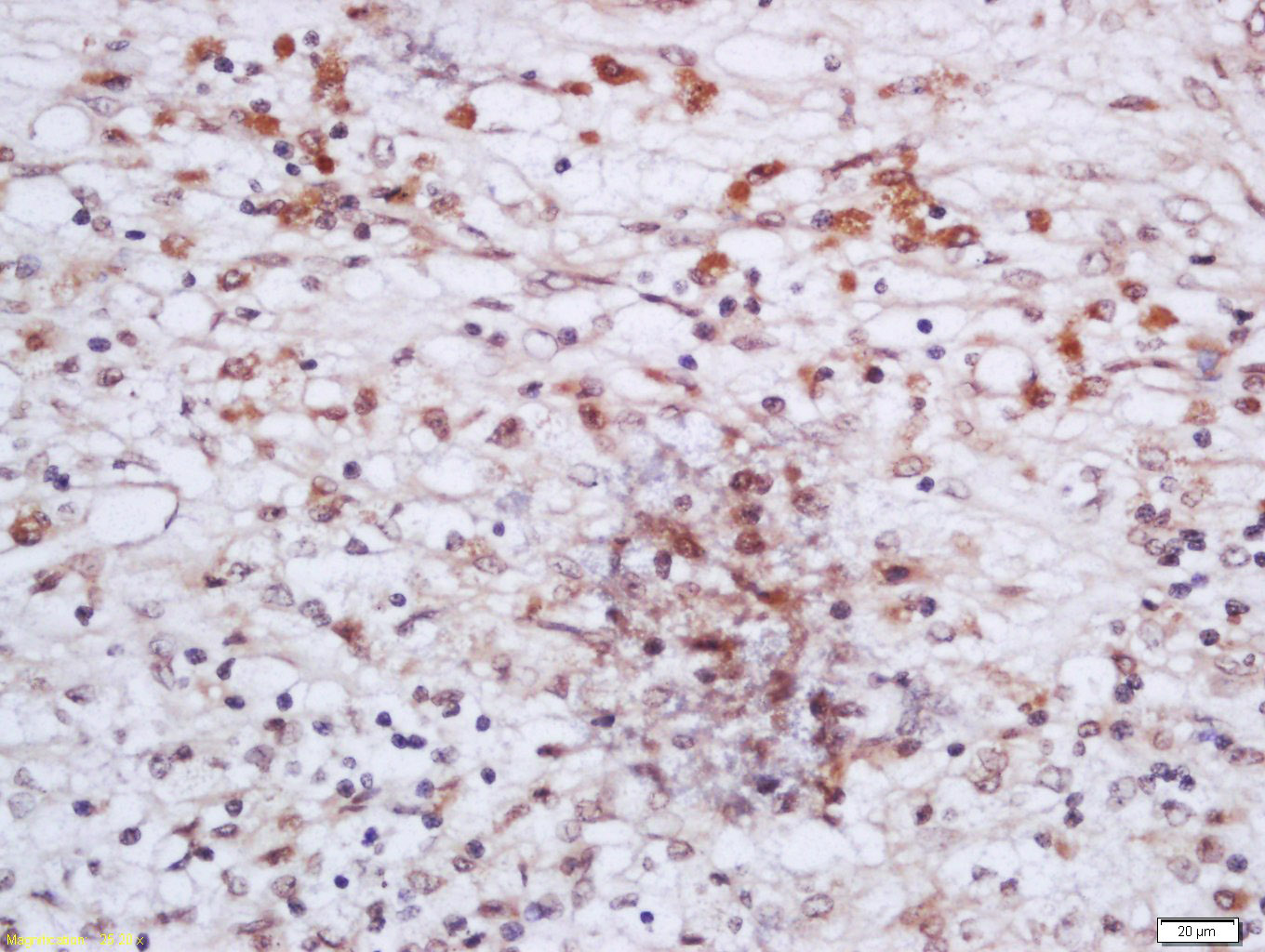 14 - CHD8 Rabbit pAb AP55336