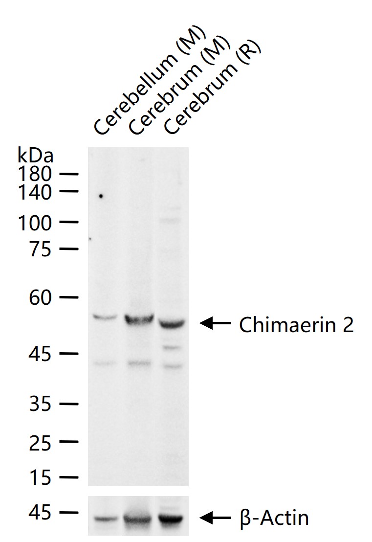 1 - Chimaerin 2 Rabbit pAb AP55338