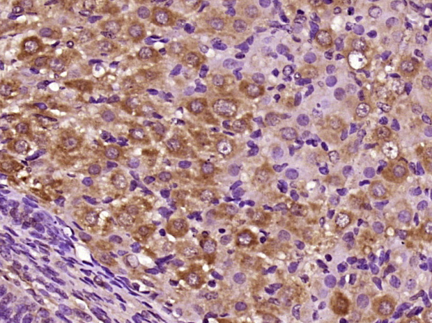 14 - CILP Rabbit pAb AP55354