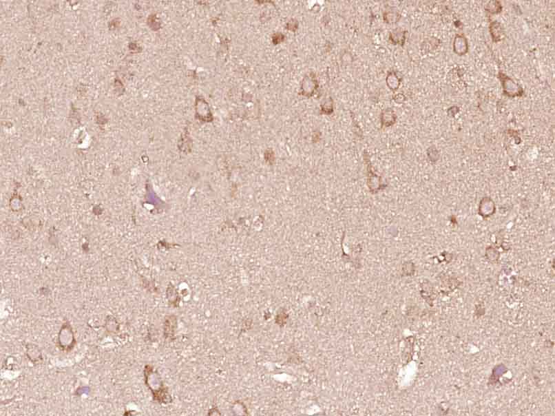 14 - CRB1 Rabbit pAb AP55395
