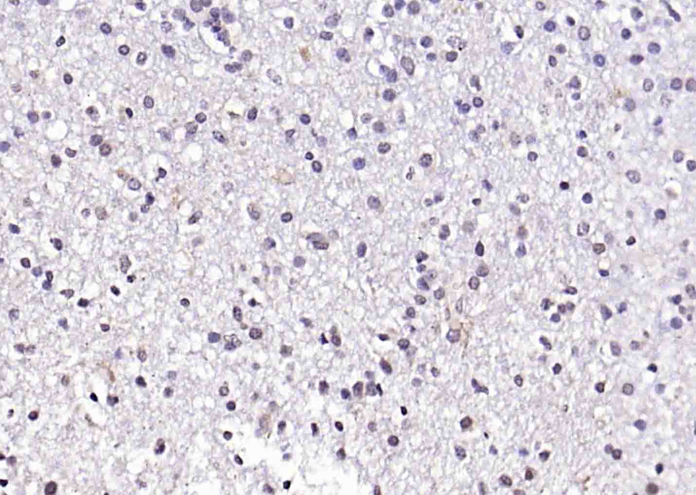 14 - CREB5 Rabbit pAb AP55398