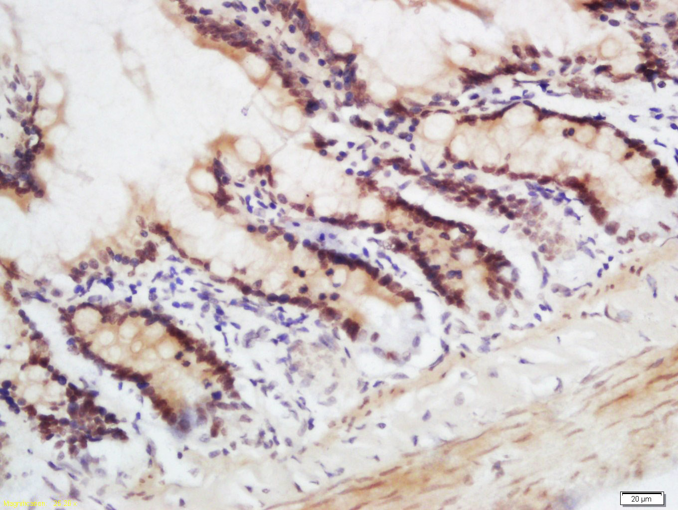 14 - CRNKL1 Rabbit pAb AP55402