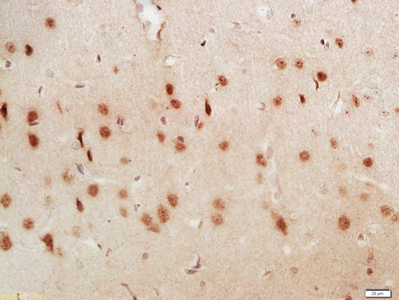 14 - CROP Rabbit pAb AP55404