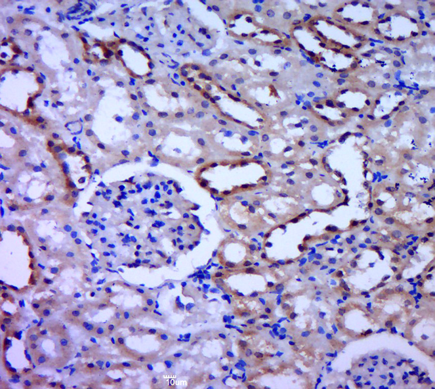 14 - CRYBB3 Rabbit pAb AP55408