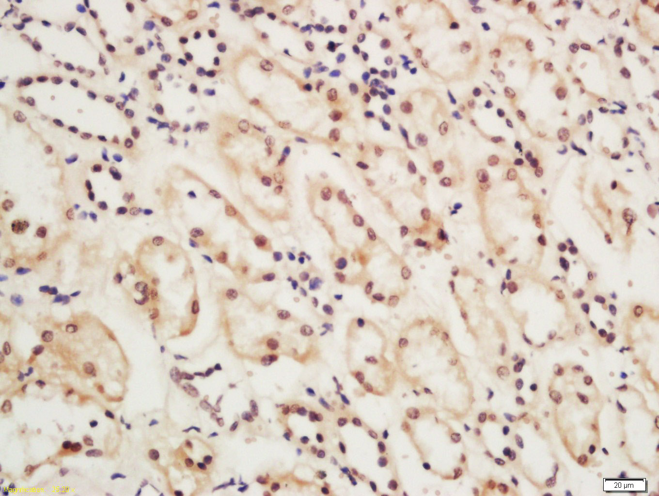 14 - CSB Rabbit pAb AP55414
