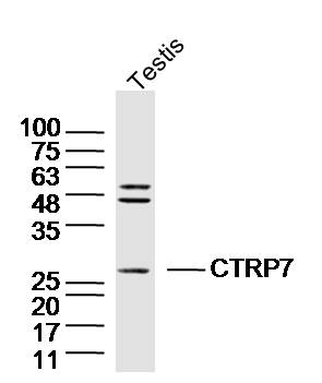 1 - CTRP7 Rabbit pAb AP55421
