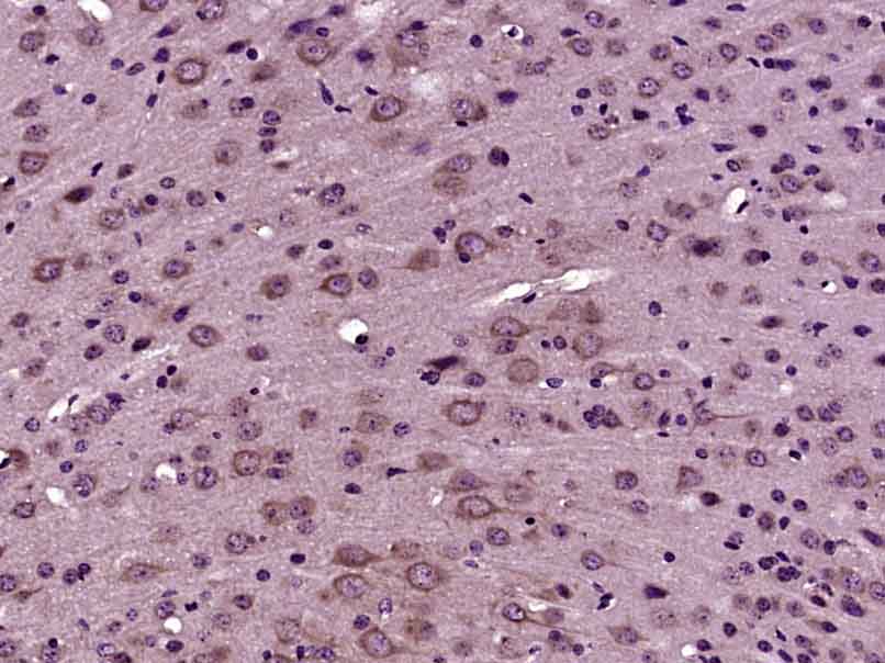 14 - CTU2 Rabbit pAb AP55424